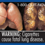 Warning label on cigarettes showing the effect of smoking on lungs